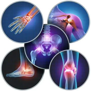 Let's get rid of arthritis
