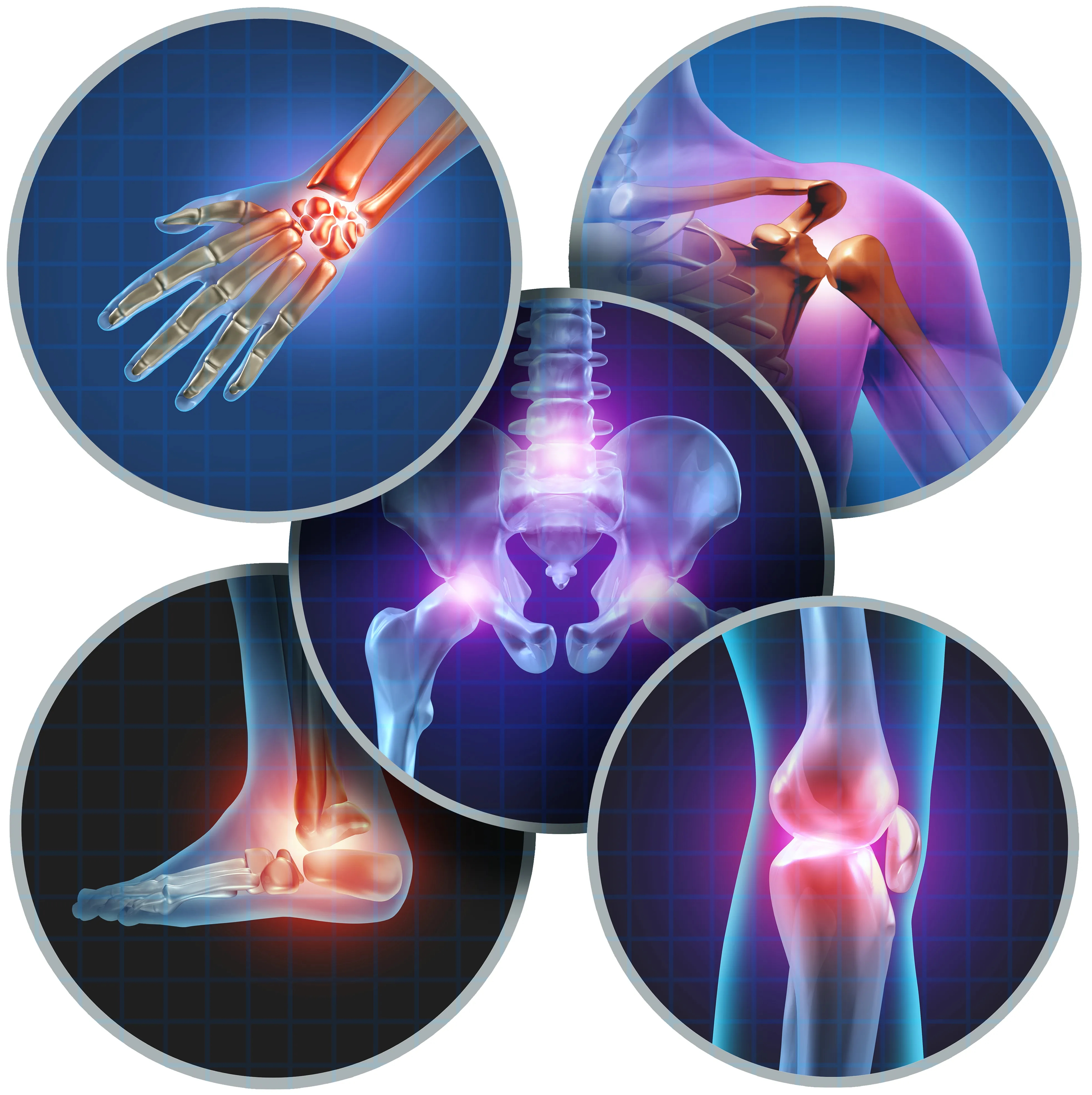 Let's get rid of arthritis